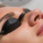 لیزر ریموو تاتو