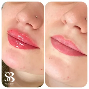 نمونه کار لب - کلینیک بیوتی صالحان