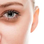 فیلر زیر چشم