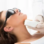 لیزر موهای زائد