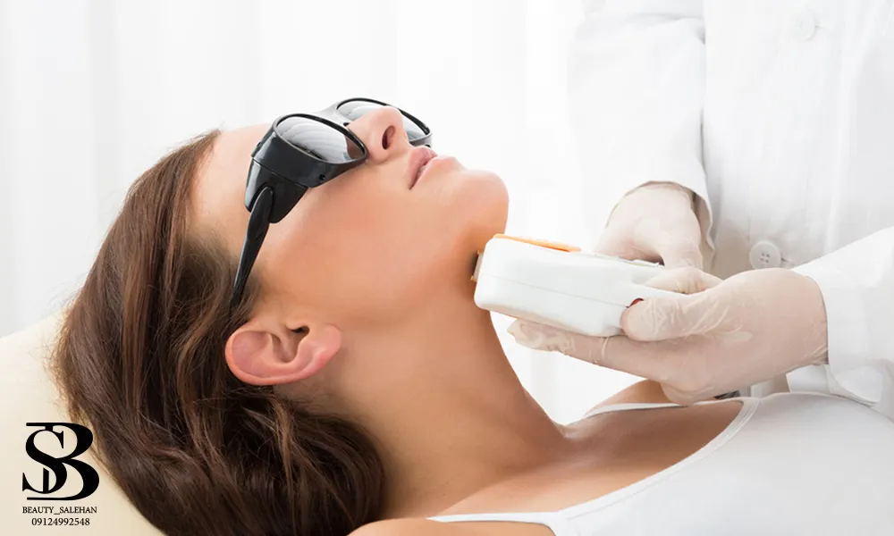 لیزر موهای زائد