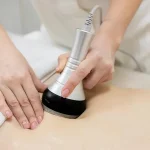 لاغری موضعی با دستگاه کویتیشن