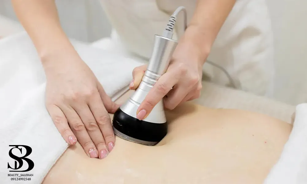 لاغری موضعی با دستگاه کویتیشن