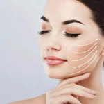 لیفت تخصصی صورت با نخ