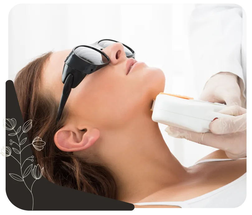 لیزر موهای زائد