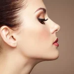 تزریق فیلر زاویه فک